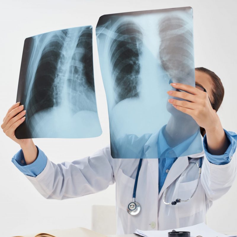 doctor with x-rays in hands hospital health research. High quality photo